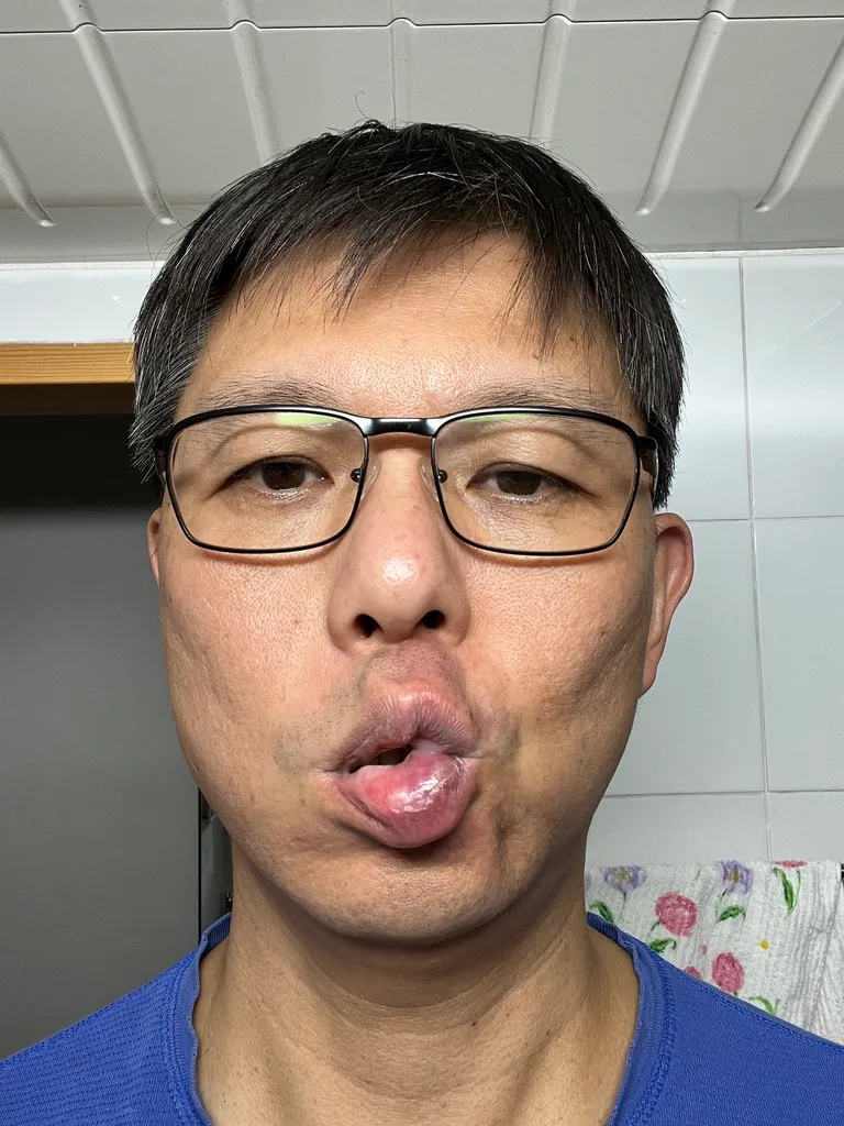 2025년 12월 17일, 표정을 지었을 때 남아 있던 비대칭